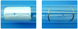 InSeal's InClosure VCD, before and after biodegredation. http://www.insealmedical.com/technology.html