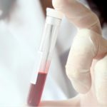 FDA Approves Blood Test for Concussion