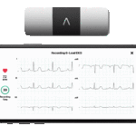 Developments in Patent Disputes Between Apple and AliveCor