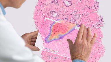 Ibex wins European approval for breast cancer-spotting AI pathology tool | Fierce Biotech